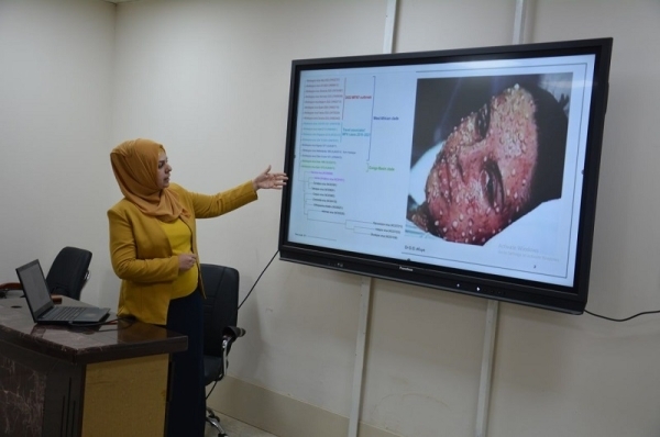 The University of Kirkuk organizes a scientific symposium on monkeypox